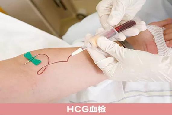 供卵试管代怀哪里找-供卵试管代怀哪里找：选择合适的中心很重要