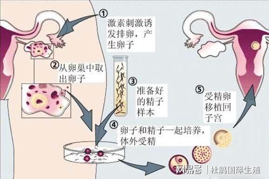 供卵是什么_供卵是什么？解读供卵的概念与过程