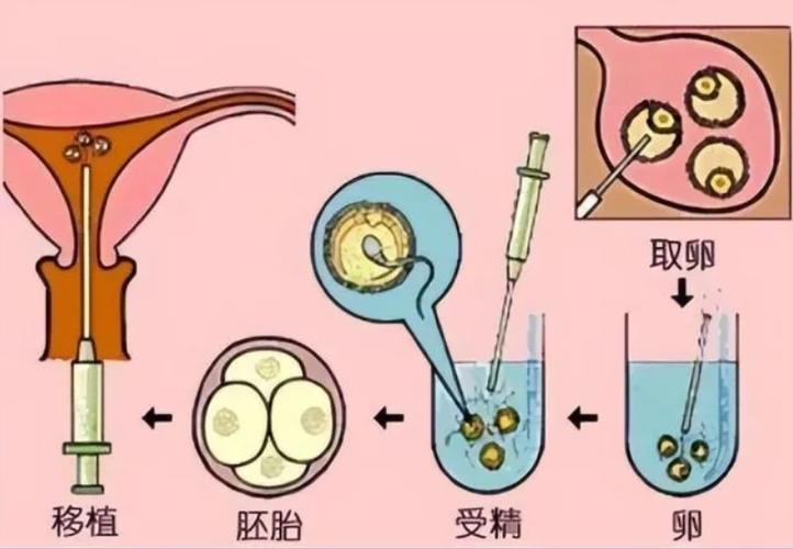 供卵试管需要什么条件-供卵试管：条件是什么？