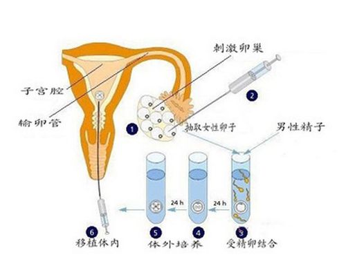 供卵需要具备什么条件(供卵需具备哪些条件？)